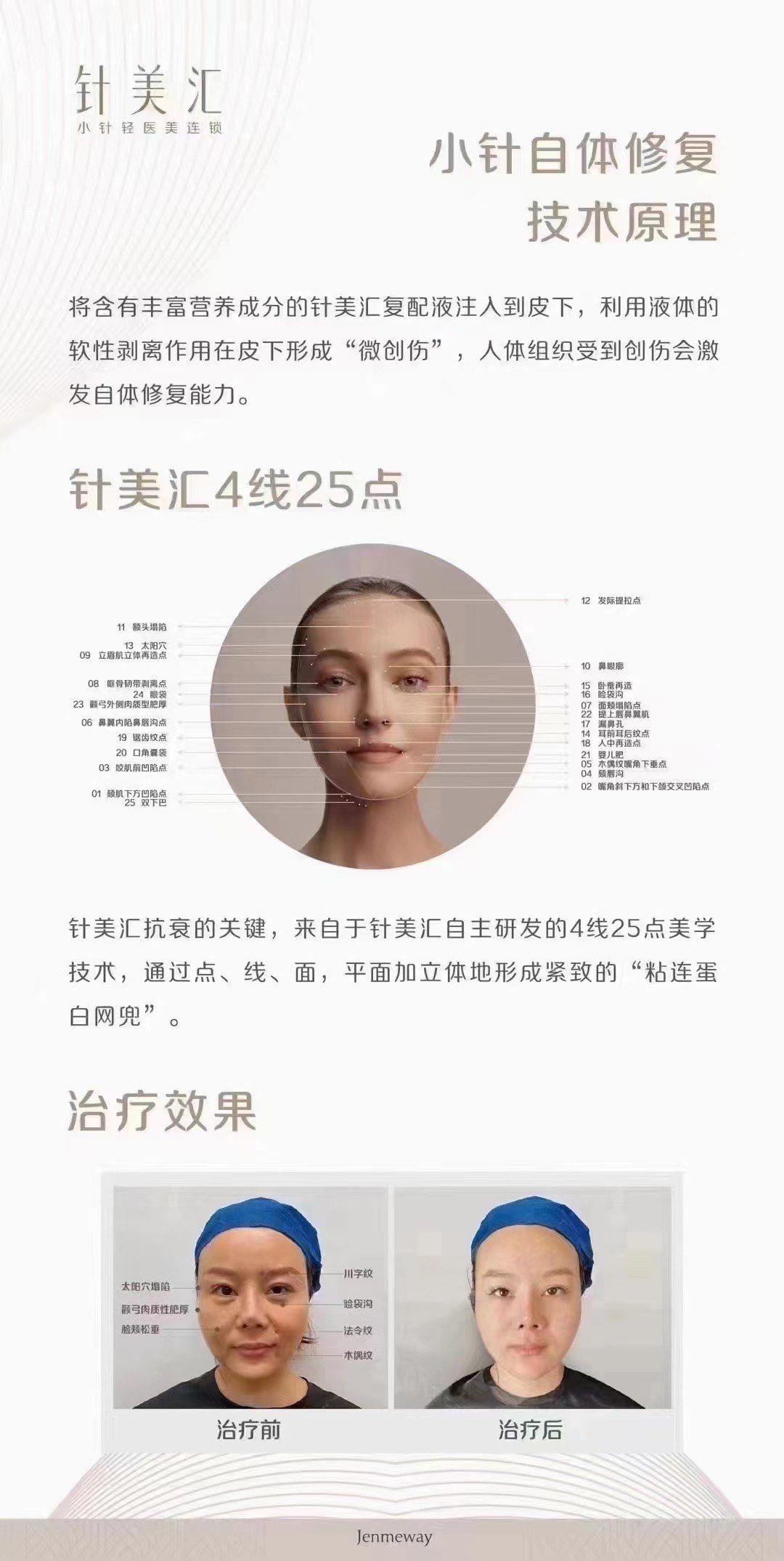 针美汇
通过4线7725点定位7750个精准抗衰点77网兜技术全脸