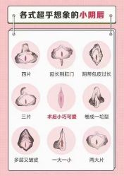 点击看大图 -雪儿海蒂·女性私密整形专科