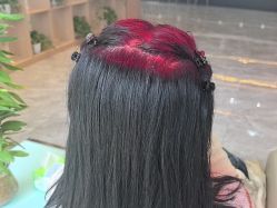 -碧莲盛·不剃发植发