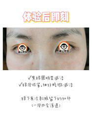 体验后-维秘形体医美 M·VVON医生集团