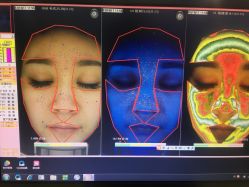 皮肤检测-光SPA科技美肤