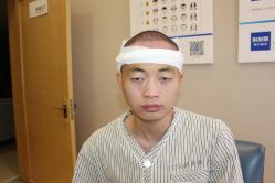 -大麦微针植发丨全国连锁