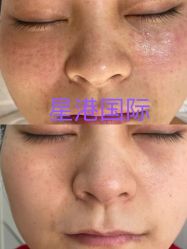 -星港国际·Skin皮肤专研·皮肤管理