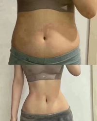 -香薇妮丝女子减肥院