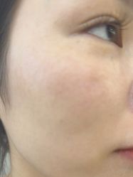 -长沙雅美医疗美容医院