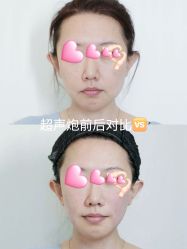-深圳艺星医疗美容医院