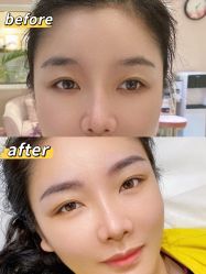 -UP&UP·半永久眉毛眼线机器野生眉