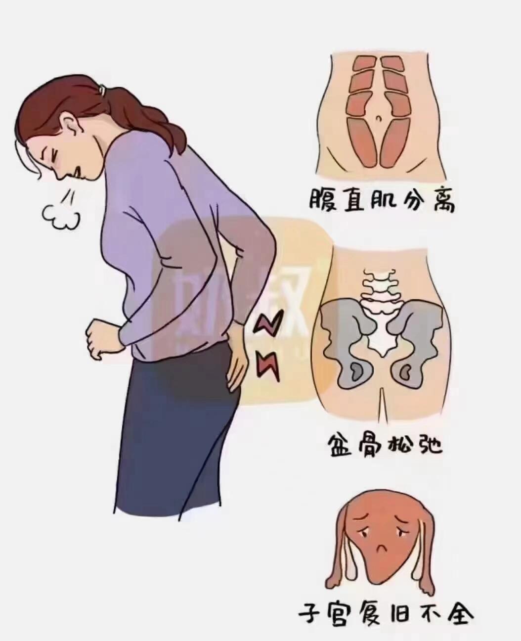 什么是产后修复