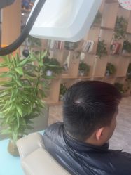 -碧莲盛·不剃发植发