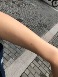 点击看大图 -日本直营PURE专业脱毛中心