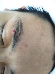 -痘博士北京·全国连锁祛痘机构