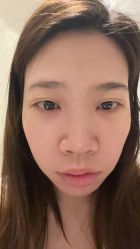 -天津健丽·去眼袋医疗美容机构