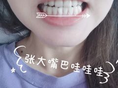 -杭州口腔医院(城西院区)