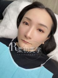 -RC半永久纹眉纹发际线
