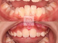-Dr.Z dental仁康种植矫正中心