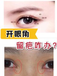 -厦门美莱整形美容医院