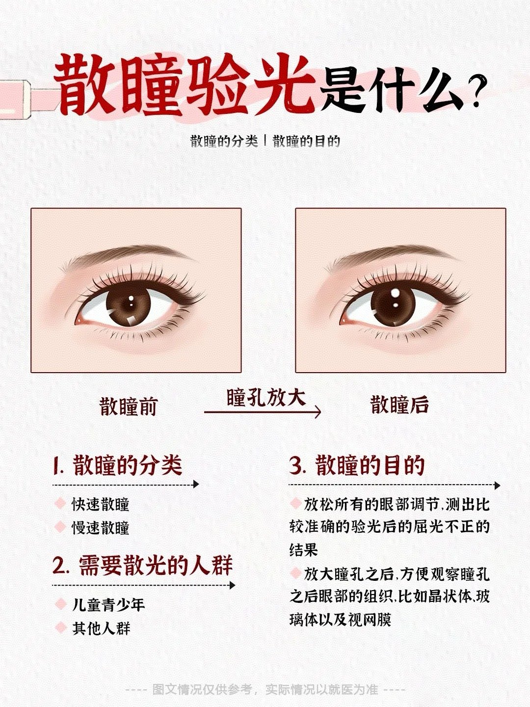 查眼底散瞳的危害