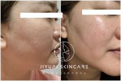 点击看大图 -MLP美丽派·问题肌疗愈中心