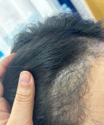 -雍禾植发全国连锁