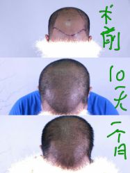 -厦门美莱整形美容医院