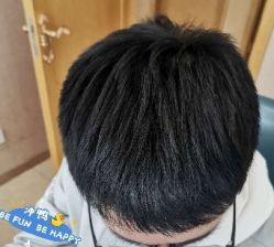 -大麦微针植发丨全国连锁