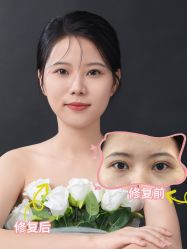 -丰联丽格医疗美容·联合丽格眼整形中心