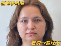 -Yestar艺星医疗美容医院