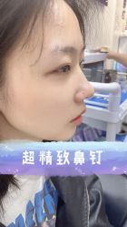 -艺耳美专业穿耳洞打耳洞穿孔