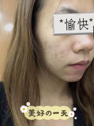 体验后-和颜一美轻医美连锁
