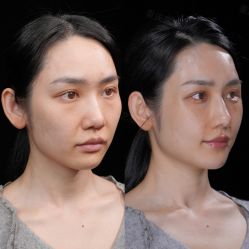 -Yestar重庆艺星医疗美容医院