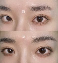 点击看大图 -OnFaer.纹眉半永久无创洗眉
