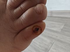 -郑远元专业修脚房·按摩·肉刺·灰指甲(苏绣路店)