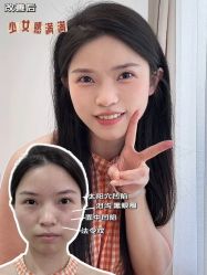 点击看大图 -Yestar重庆艺星医疗美容医院