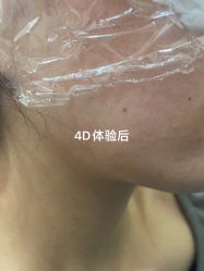 体验后-重庆联合丽格第五医疗美容医院