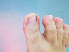 -新甲连锁灰指甲·甲沟炎·鸡眼(黑龙江路店)