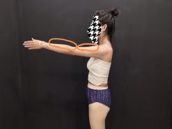 体验前-禾美嘉医疗美容