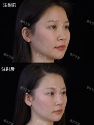 -Yestar重庆艺星医疗美容医院