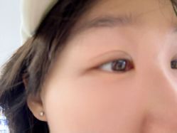 -天津健丽·去眼袋医疗美容机构
