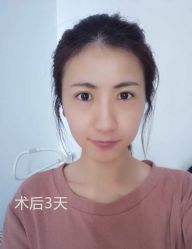 -天津健丽·去眼袋医疗美容机构