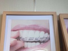-上海仁爱医院口腔科 · 种植