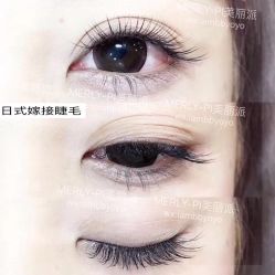 -MLP美丽派·问题肌疗愈中心