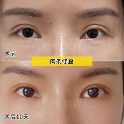 -丰联丽格医疗美容·联合丽格眼整形中心