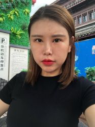 -天津健丽·去眼袋医疗美容机构