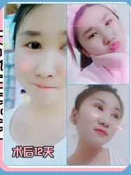 -广东韩妃整形外科医院