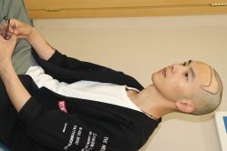 点击看大图 -大麦微针植发丨全国连锁