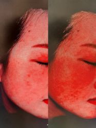 -和颜一美轻医美连锁