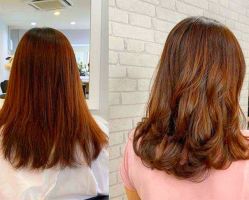 -大麦微针植发全国连锁