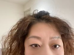 -天津健丽·去眼袋医疗美容机构