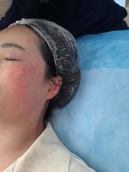-长沙雅美医疗美容医院