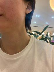 -丽美妍医疗美容·皮秒·立体分层抗衰